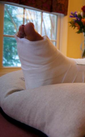 Kontuzje kończyn dolnych dotyczą nawet 70 proc. biegaczy. Aby ograniczyć ich ryzyko, warto wykonać badania funkcjonalne